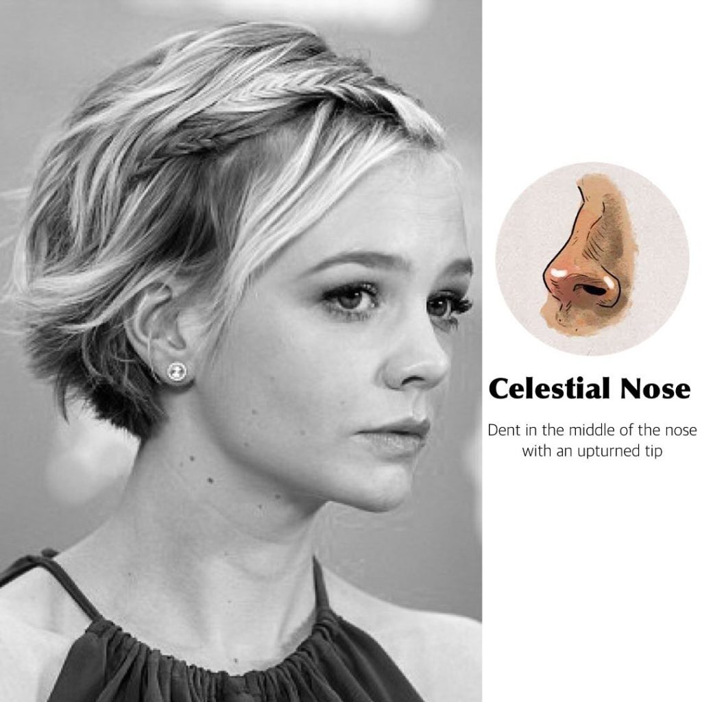 Different noses دکتر حسام جهاندیده