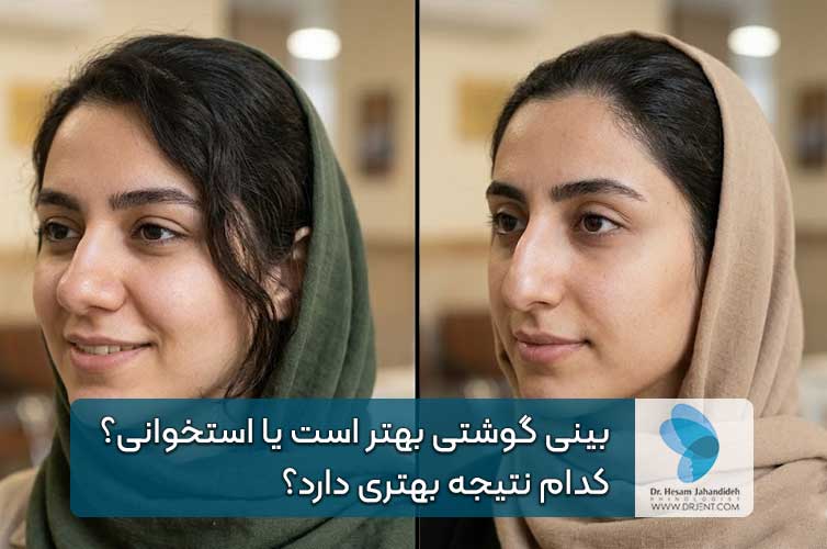 بینی گوشتی بهتر است یا استخوانی؟ کدام نتیجه بهتری دارد؟