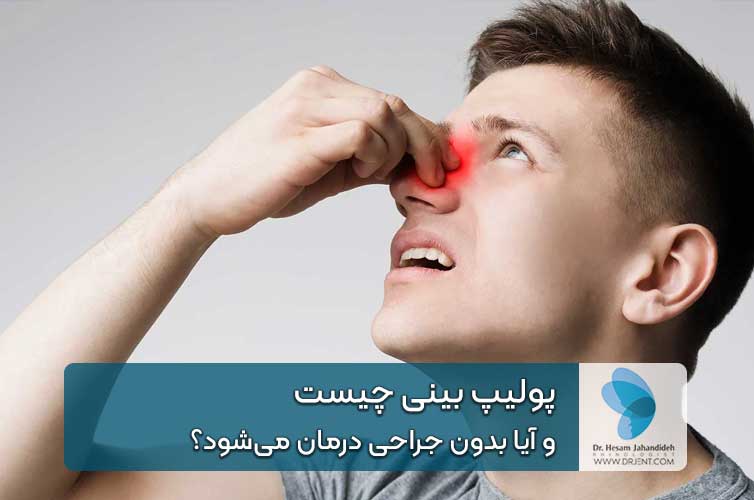 پولیپ بینی چیست و آیا بدون جراحی درمان میشود؟