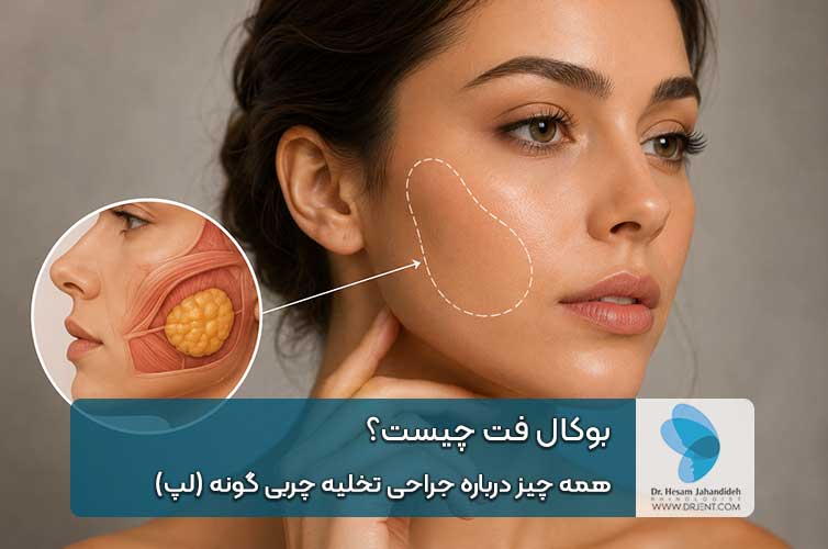 جراحی بوکال فت