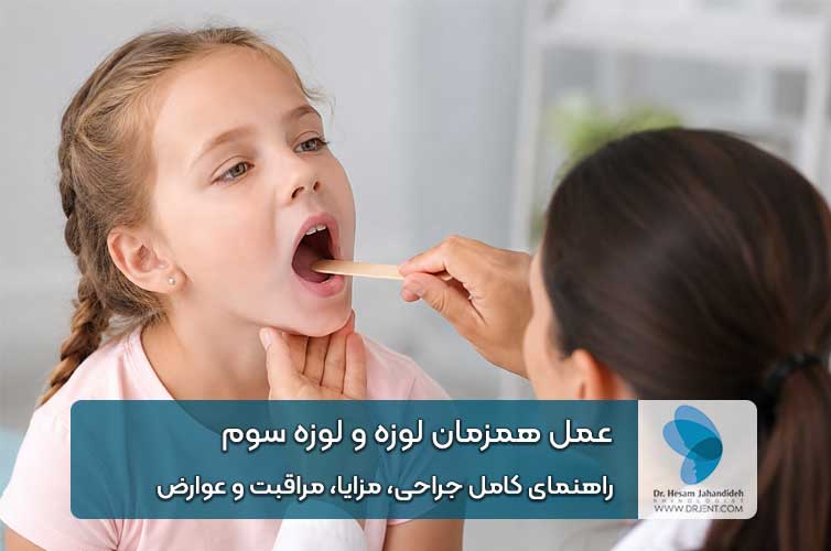 عمل همزمان لوزه و لوزه سوم