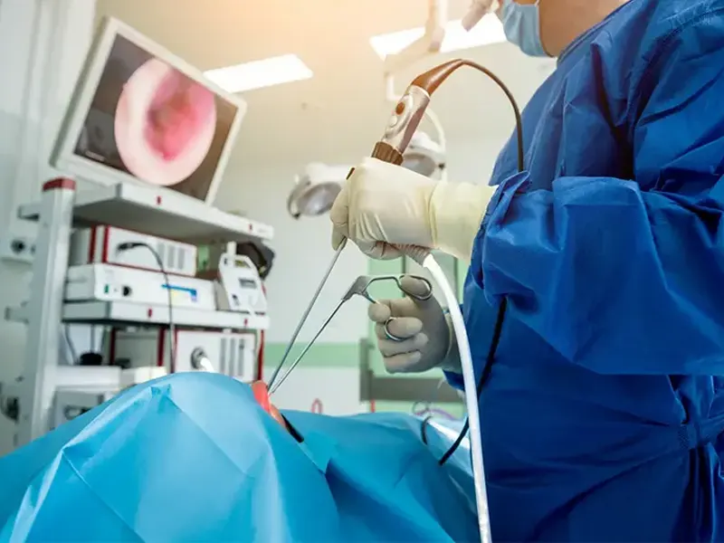 آندوسکوپی بینی برای تشخیص سینوزیت و آلرژی